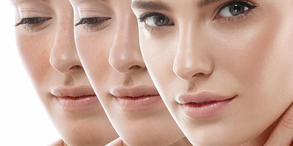 Les tâches pigmentaires Atténuation des taches pigmentaires