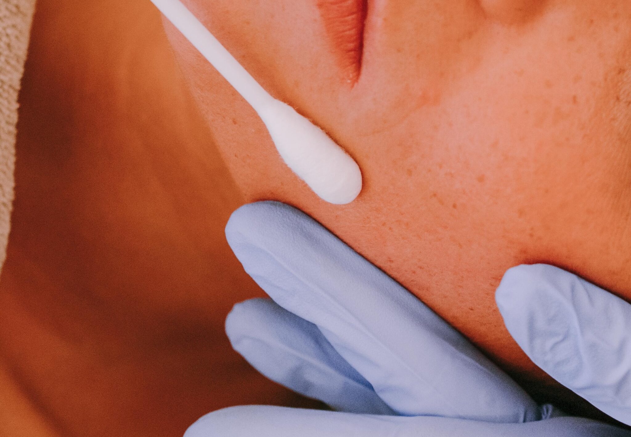 Soin ph-formula Peeling pHformula